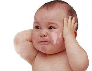 哪些因素引发幼儿白癜风的?(图1)