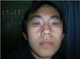 患上白癜风的原因是啥呢?(图1)